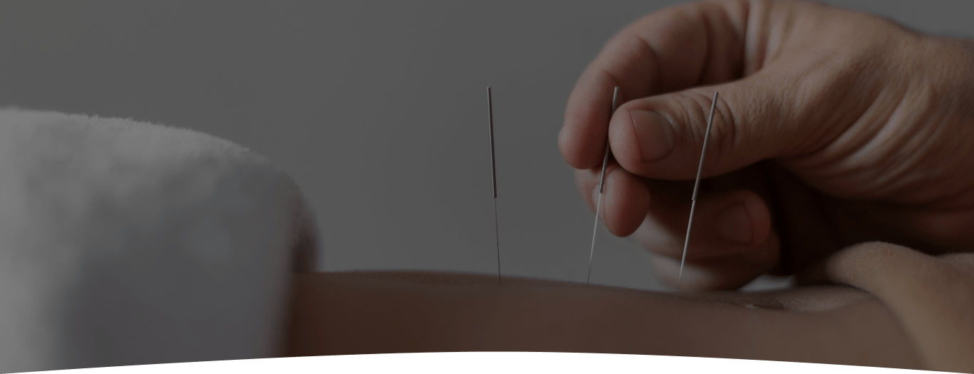 close-up hand holding acupuncture needle