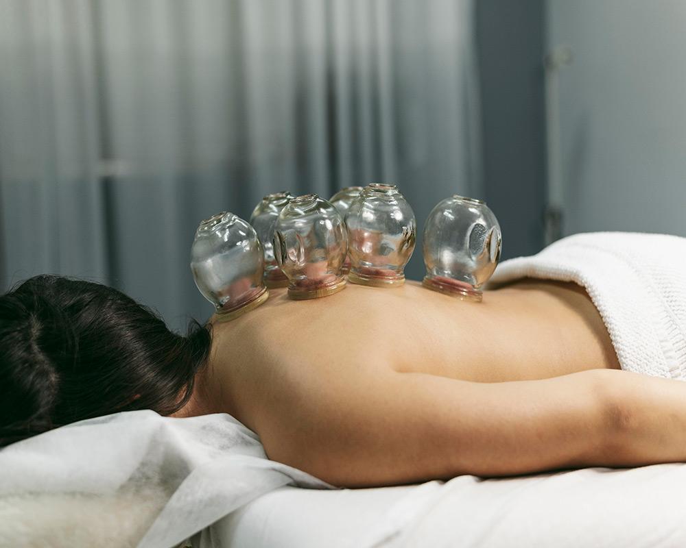 A woman lies face down on a massage table while a therapist applies suction cups to her back. The therapist holds a rubber bulb in one hand and a cup in the other, creating a vacuum that pulls the skin and muscle upward into the cup. The client's back is marked with several circular bruises from previous cupping sessions. The room is dimly lit and decorated with plants and a wooden Buddha statue on a shelf in the background