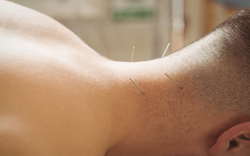 The sick man is doing the acupuncture procedure and takes a dry needle on the neck