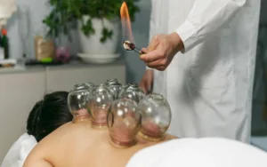 Cupping Therapy in Health and Wellness Center