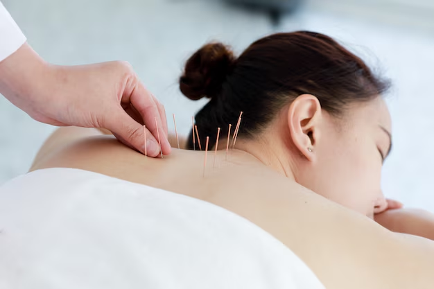 Discover the Top Benefits of Acupuncture Massage Near You in Toronto