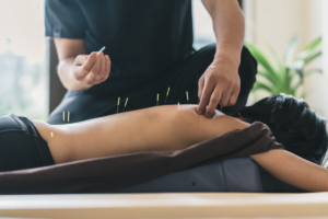 Benefits of Acupuncture Massage Near You: A Guide to Relaxation and Pain Relief